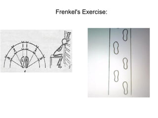 Frenkel's Exercise:
 