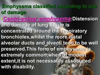 Emphysema classified according to site of damage:•Centri-acinar emphysema:Distension and damage of lung tissue is concentrated around the respiratory bronchioles,whilst the more distal alveolar ducts and alveoli tend to be well preserved.This form of emphysema is extremely common;when of modest extent,it is not necessarily associated with disability.   