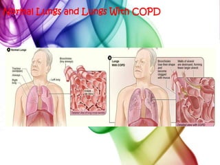 The airways make more mucus than usual, which tends to clog them. 