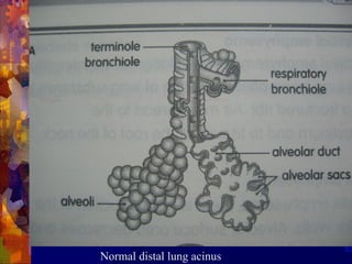 Normal Acinus Copd(chronic obstructive pulmonary disease) | PPT