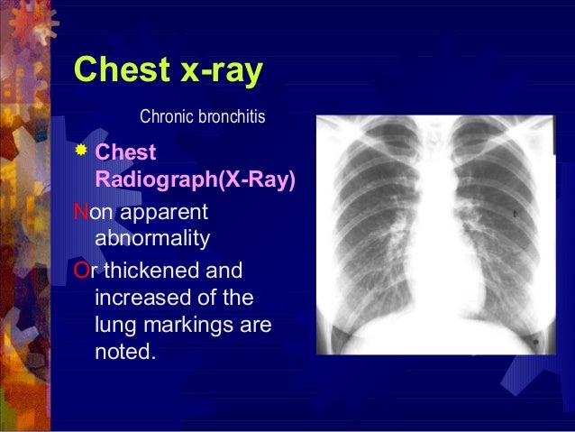 Copd