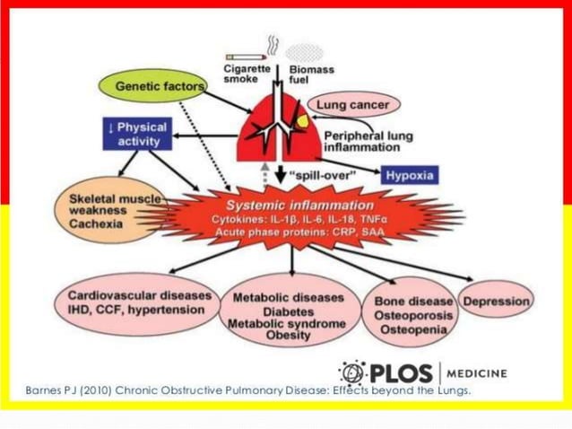 Systemic Effects COPD systemic effects and comorbidities | PPT