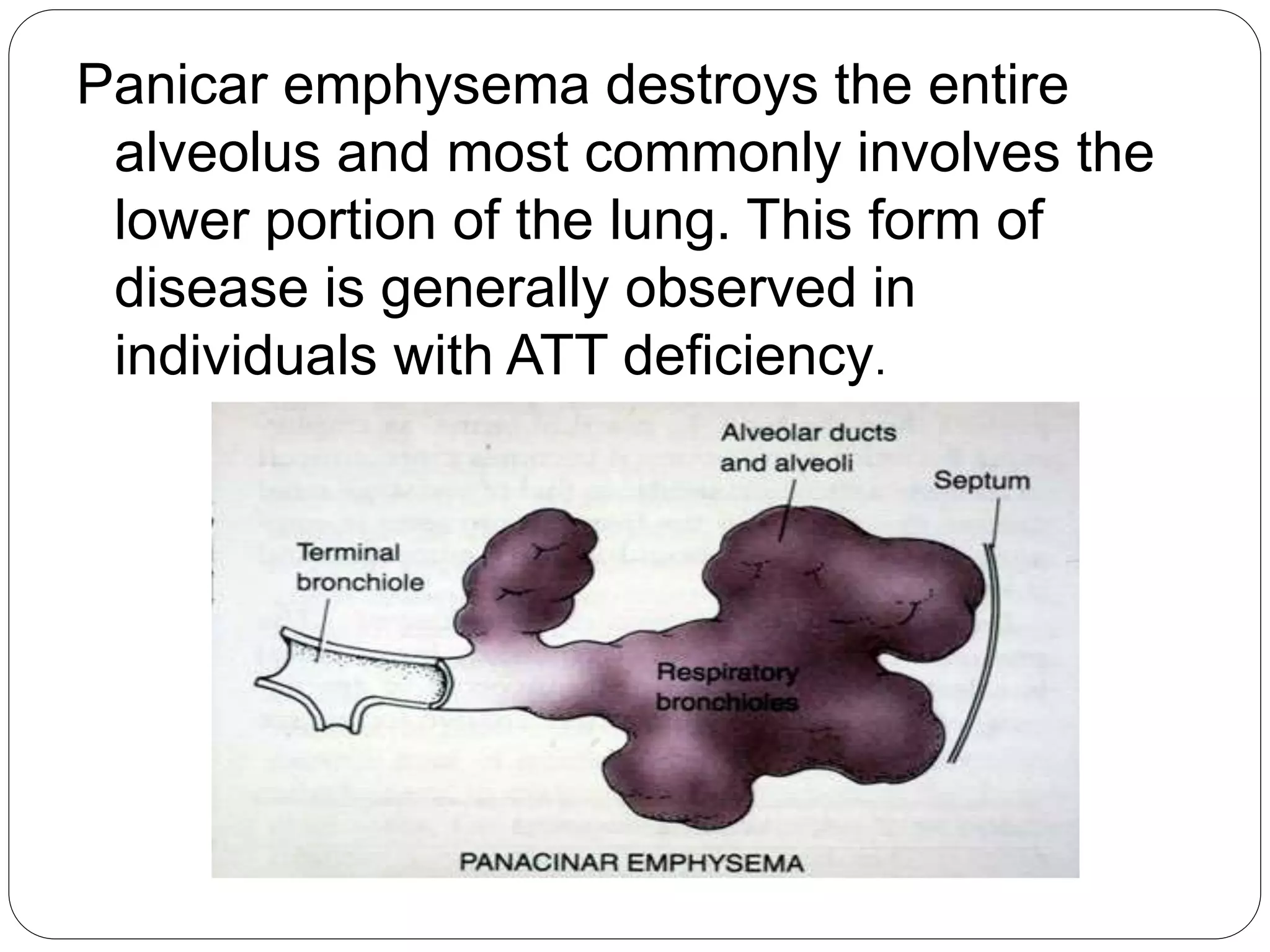 Panicar emphysema destroys the entire
alveolus and most commonly involves the
lower portion of the lung. This form of
disease is generally observed in
individuals with ATT deficiency.
 