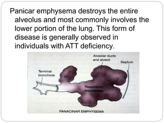 Panicar emphysema destroys the entire
alveolus and most commonly involves the
lower portion of the lung. This form of
disease is generally observed in
individuals with ATT deficiency.
 