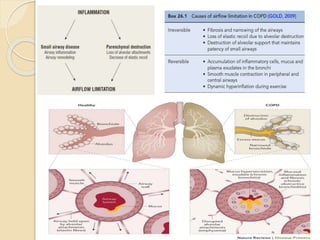 Copd | PPTX