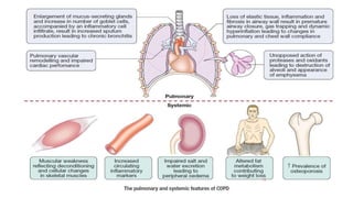 COPD | PPTX