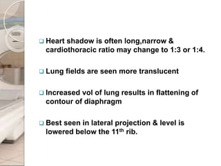  Heart shadow is often long,narrow &
cardiothoracic ratio may change to 1:3 or 1:4.
 Lung fields are seen more translucent
 Increased vol of lung results in flattening of
contour of diaphragm
 Best seen in lateral projection & level is
lowered below the 11th rib.
 