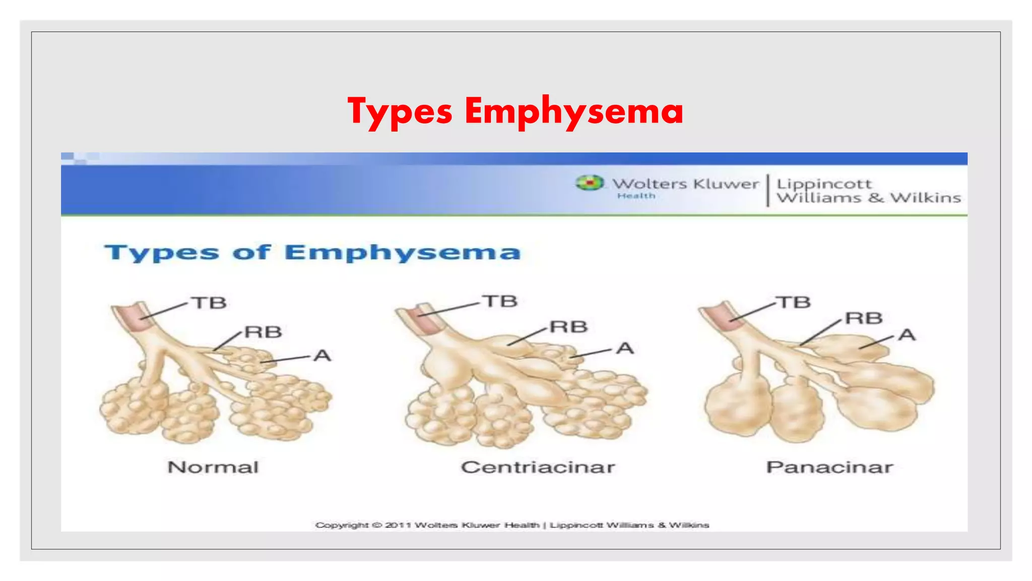 CHRONIC OBSTRUCTIVE PULMONARY DISEASE (COPD) | PPTX