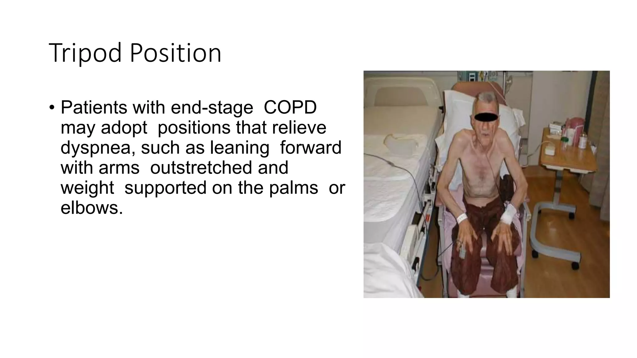 Tripod Position
• Patients with end-stage COPD
may adopt positions that relieve
dyspnea, such as leaning forward
with arms outstretched and
weight supported on the palms or
elbows.
 