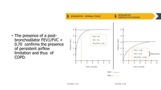 • The presence of a post-
bronchodilator FEV1/FVC <
0.70 confirms the presence
of persistent airflow
limitation and thus of
COPD.
 