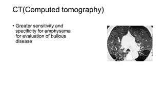 CT(Computed tomography)
• Greater sensitivity and
specificity for emphysema
for evaluation of bullous
disease
 