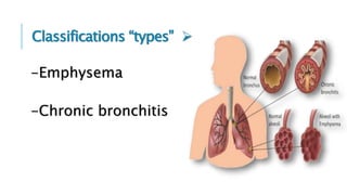 COPD(Chronic Obstructive Pulmonary Disease) a7med-mo7amed | PPTX