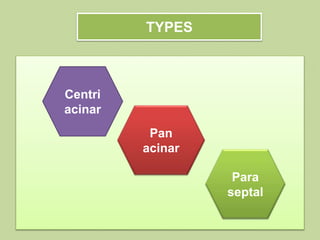 TYPES
Pan
acinar
Centri
acinar
Para
septal
 