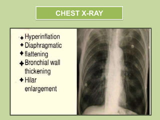CHEST X-RAY
 