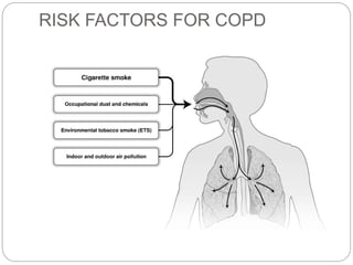 RISK FACTORS FOR COPD
 