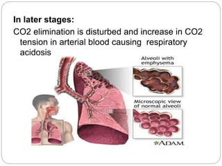In later stages:
CO2 elimination is disturbed and increase in CO2
tension in arterial blood causing respiratory
acidosis
 