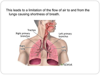 This leads to a limitation of the flow of air to and from the
lungs causing shortness of breath.
 