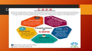 COPD.pdf