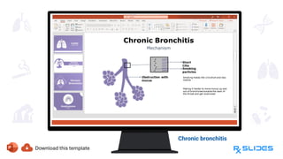 Chronic bronchitis
 