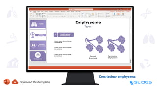 Centriacinar emphysema
Primarily affects the
central or proximal
parts of the acinus.
 