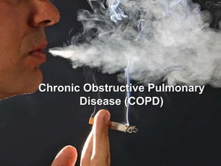 Chronic Obstructive Pulmonary
Disease (COPD)
 