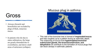 Gross
• Airways (bronchi and
bronchioles) are occluded by
plugs of thick, tenacious
mucus.
• In patients who die due to
status asthmaticus, the lungs
are greatly distended due to
overinflation, and shows small
areas of atelectasis (collapse).
 