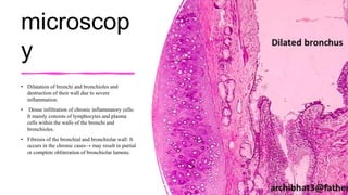 microscop
y
• Dilatation of bronchi and bronchioles and
destruction of their wall due to severe
inflammation.
• Dense infiltration of chronic inflammatory cells:
It mainly consists of lymphocytes and plasma
cells within the walls of the bronchi and
bronchioles.
• Fibrosis of the bronchial and bronchiolar wall: It
occurs in the chronic cases→ may result in partial
or complete obliteration of bronchiolar lumens.
 