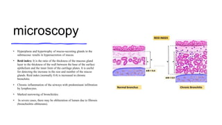 microscopy
• Hyperplasia and hypertrophy of mucus-secreting glands in the
submucosa: results in hypersecretion of mucus.
• Reid index: It is the ratio of the thickness of the mucous gland
layer to the thickness of the wall between the base of the surface
epithelium and the inner limit of the cartilage plates. It is useful
for detecting the increase in the size and number of the mucus
glands. Reid index (normally 0.4) is increased in chronic
bronchitis.
• Chronic inflammation of the airways with predominant infiltration
by lymphocytes.
• Marked narrowing of bronchioles:
• In severe cases, there may be obliteration of lumen due to fibrosis
(bronchiolitis obliterans).
 
