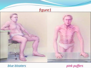 blue bloaters pink puffers
figure1
 