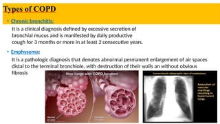 Cjronic obstructive pulmonary diseases Copd .pptx