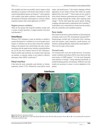 International Journal of COPD 2014:9 submit your manuscript | www.dovepress.com
Dovepress
Dovepress
843
Noninvasive ventilation in acute respiratory failure
This modality has been successfully used to improve sleep
disturbances in patients with chronic heart failure in whom
central and peripheral apneas are frequent,148
and in patients
with complex sleep apnea syndrome, characterized by the
development of frequent central apneas or a Cheyne–Stokes
respiratory pattern after initial application of CPAP.147
Negative pressure ventilation
There are few groups still using this modality, usually with
a cuirass or jacket (poncho), to support patients with chest
wall disorders.127
Interfaces
Whatever NIV technique is used, an interface is needed to
connect the patient to a ventilator or to an air/oxygen source
(Figure 2). Interfaces are devices that connect the ventilator
tubing to the patient’s face and facilitate the entry of pres-
surized gas into the upper airway. Interface-related problems
are, by far, the most common reason for NIV intolerance.
Patient comfort and synchrony are essential when choosing
an interface, as internal volume is not related to effective
dead space when NIPSV is delivered.149
Nasal interface
It has been the most commonly used interface in chronic
respiratory failure (73%), followed by nasal pillow, facial
masks, and mouth pieces,150
this trend is changing with the
application of new modes of home NIV, which are usually
applied with a face mask.47,51
Nasal masks are less useful in
acute critical situations, generating more resistance151,152
and
massive leakage through the mouth, often requiring mask
change.153
On the other hand, they permit speech, feeding,
coughing, and expectoration, reducing the risk of vomiting.150
Nasal pillows are a variant that are inserted into the nostrils;
these are commonly used in pediatric patients.
Face masks
Face masks are the most common interface in clinical practice
in Europe, used in over 70% of all patients requiring NIV.154
Disadvantages include lack of protection from vomiting,
nasal skin injuries, nasal congestion, mouth dryness, eye
irritation, speaking difficulty, and possible claustrophobia.153
There are two types of face masks.
Oronasal masks
An oronasal mask covers the mouth and nose. It increases
minute ventilation and reduces PaCO2
more ­effectively than
nasal masks in COPD patients.151
It is the most frequently
used interface in Europe,154
being indicated specifically in
mouth-breathing patients with dyspnea. ­Different sizes and
models are necessary to ensure a correct adaptation to the
patient.
Figure 2 Interfaces for noninvasive ventilation.
Notes: (A) nasal mask; (B and C) oro-nasal masks; (D and E) full-face masks; (F) helmet; (G) nasal pillows. Pictures (A) and (G) were provided by JM Carratalà from
H Universitario de Alicante, Spain.
 