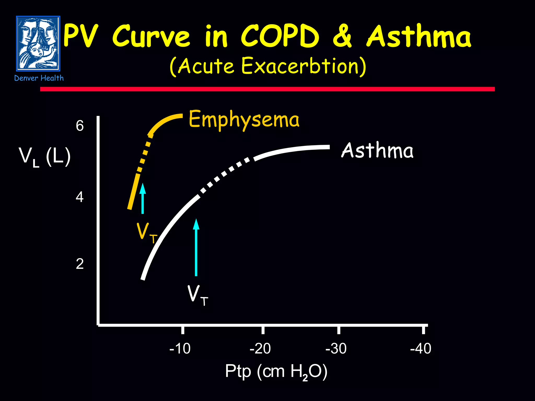 PV Curve in COPD & Asthma (Acute Exacerbtion) -10 -20 -30 -40 2 4 6 Ptp (cm H 2 O) V L  (L) V T V T Asthma Emphysema Denver Health 