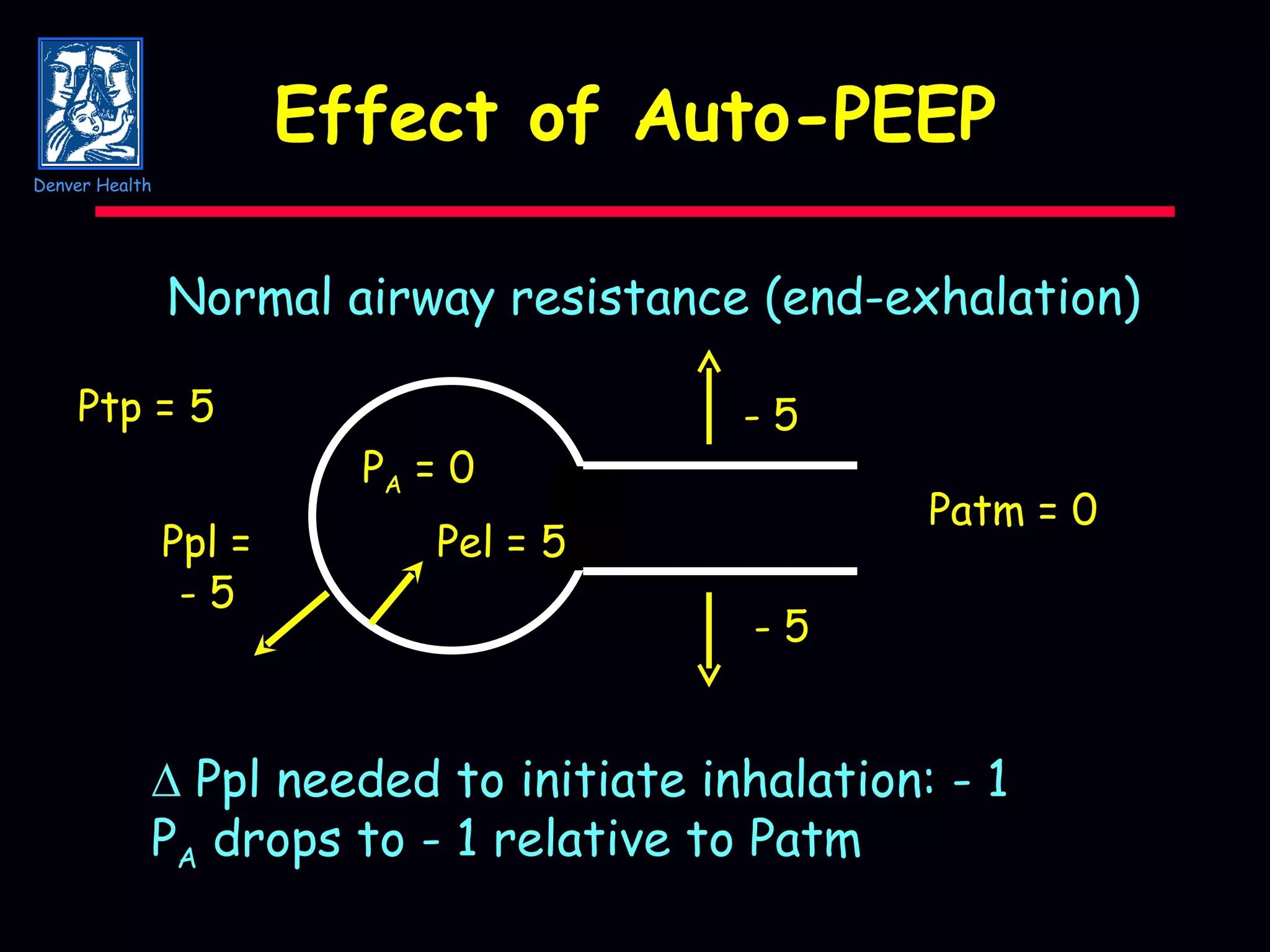 Effect of Auto-PEEP Patm = 0 P A  = 0 Ppl = - 5 Normal airway resistance (end-exhalation) Pel = 5    Ppl needed to initiate inhalation: - 1 P A  drops to - 1 relative to Patm - 5 - 5 Ptp = 5 Denver Health 