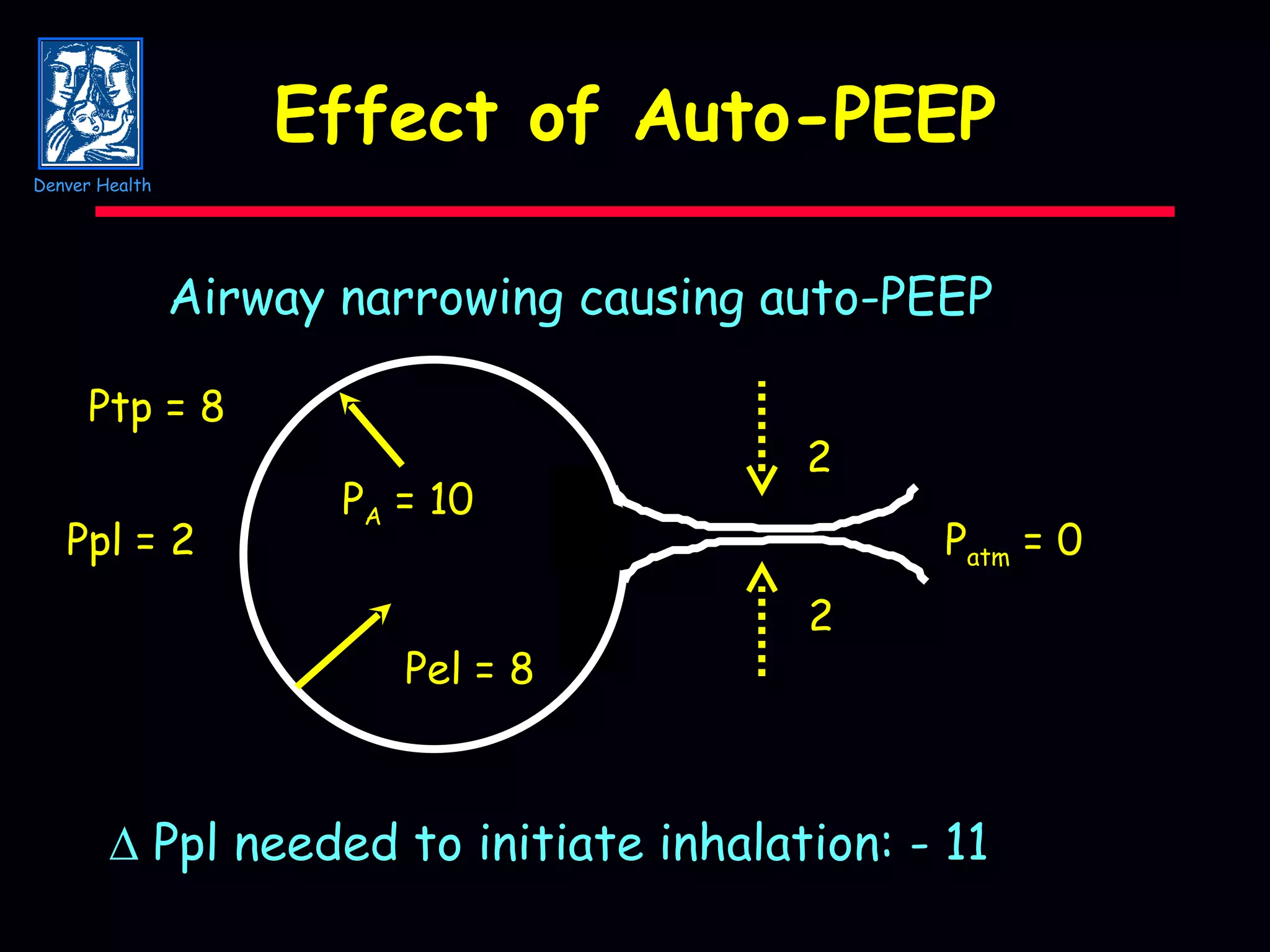 Effect of Auto-PEEP P A  = 10 Airway narrowing causing auto-PEEP P atm  = 0 Ppl = 2 Pel = 8    Ppl needed to initiate inhalation: - 11 2 2 Ptp = 8 Denver Health 