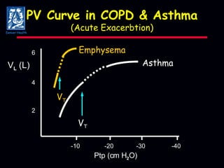 PV Curve in COPD & Asthma (Acute Exacerbtion) -10 -20 -30 -40 2 4 6 Ptp (cm H 2 O) V L  (L) V T V T Asthma Emphysema Denver Health 