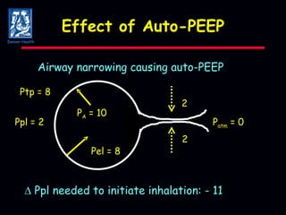 Effect of Auto-PEEP P A  = 10 Airway narrowing causing auto-PEEP P atm  = 0 Ppl = 2 Pel = 8    Ppl needed to initiate inhalation: - 11 2 2 Ptp = 8 Denver Health 