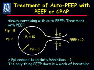 Treatment of Auto-PEEP with PEEP or CPAP Airway narrowing with auto-PEEP: Treatment with PEEP P A  = 10 PEEP = 10 Ppl 2 Pel = 8    Ppl needed to initiate inhalation: - 1 The only thing PEEP does is    work of breathing 2 2 Ptp = 8 Denver Health 