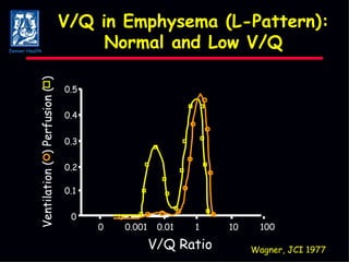 Mechanical Ventilation of Patients with COPD and Asthma | PPT