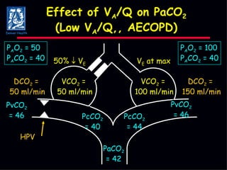 Effect of V A /Q on PaCO 2 (Low V A /Q,, AECOPD) PcCO 2 = 44 PaCO 2 = 42 PcCO 2 = 40 PvCO 2 = 46 PvCO 2 = 46 DCO 2  =  50 ml/min HPV V E  at max 50%    V E VCO 2  =  50 ml/min VCO 2  =  100 ml/min DCO 2  =  150 ml/min P A O 2  = 50 P A CO 2  = 40 P A O 2  = 100 P A CO 2  = 40 Denver Health 