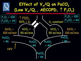 Effect of V A /Q on PaCO 2 (Low V A /Q,, AECOPD,    F I O 2 ) PcCO 2 = 44 PaCO 2 = 44 PcCO 2 = 44 PvCO 2 = 46 PvCO 2 = 46 DCO 2  =  100 ml/min HPV V E  constant 50%    V E VCO 2  =  50 ml/min VCO 2  =  50 ml/min DCO 2  =  100 ml/min    FIO 2 P A O 2  = 100 P A CO 2  = 44 P A O 2  = 100 P A CO 2  = 44 Denver Health 