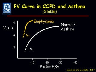 PV Curve in COPD and Asthma (Stable) Macklem and Becklake, 1963 -10 -20 -30 -40 2 4 6 Ptp (cm H 2 O) V L  (L) V T V T Normal/ Asthma Emphysema Denver Health 