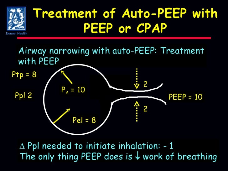 Mechanical Ventilation of Patients with COPD and Asthma