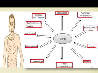 13
Common Comorbidities
 