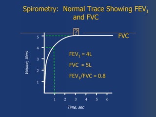 Spirometry: Normal Trace Showing FEV1
and FVC
1 2 3 4 5 6
1
2
3
4
Volume,liters
Time, sec
FVC5
1
FEV1 = 4L
FVC = 5L
FEV1/FVC = 0.8
 