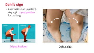 Dahl’s sign
• A dermititis due to patient
staying in tripod position
for too long
Tripod Position Dahl’s sign
 