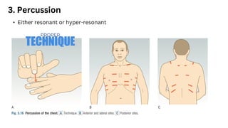 3. Percussion
• Either resonant or hyper-resonant
TECHNIQUE
PROPER
 
