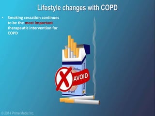 • Smoking cessation continues
to be the most important
therapeutic intervention for
COPD
 