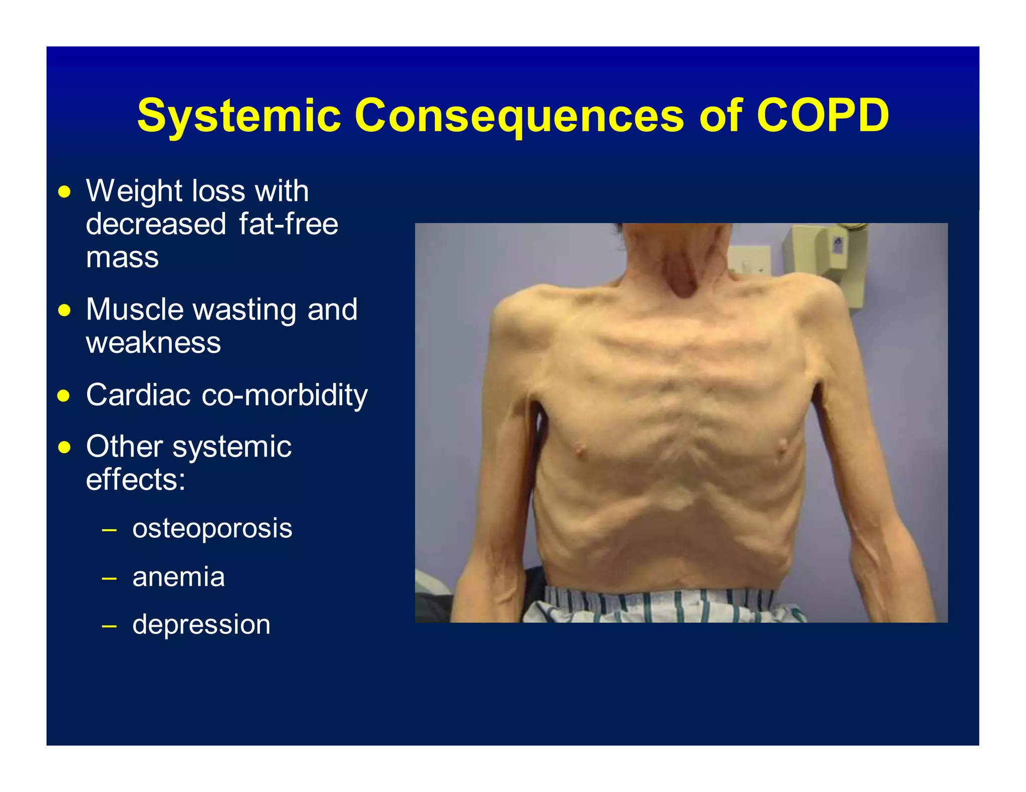 Systemic Consequences of COPD
 Weight loss with
decreased fat-free
mass
 Muscle wasting and
weakness
 Cardiac co-morbidity
 Other systemic
effects:
– osteoporosis
– anemia
– depression
 