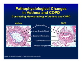 Copd and asthma | DOCX