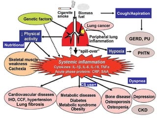 Lung fibrosis
Cough/Aspiration
GERD, PU
+CS use
PHTN
Nutritional
Dyspnea
CKD
 
